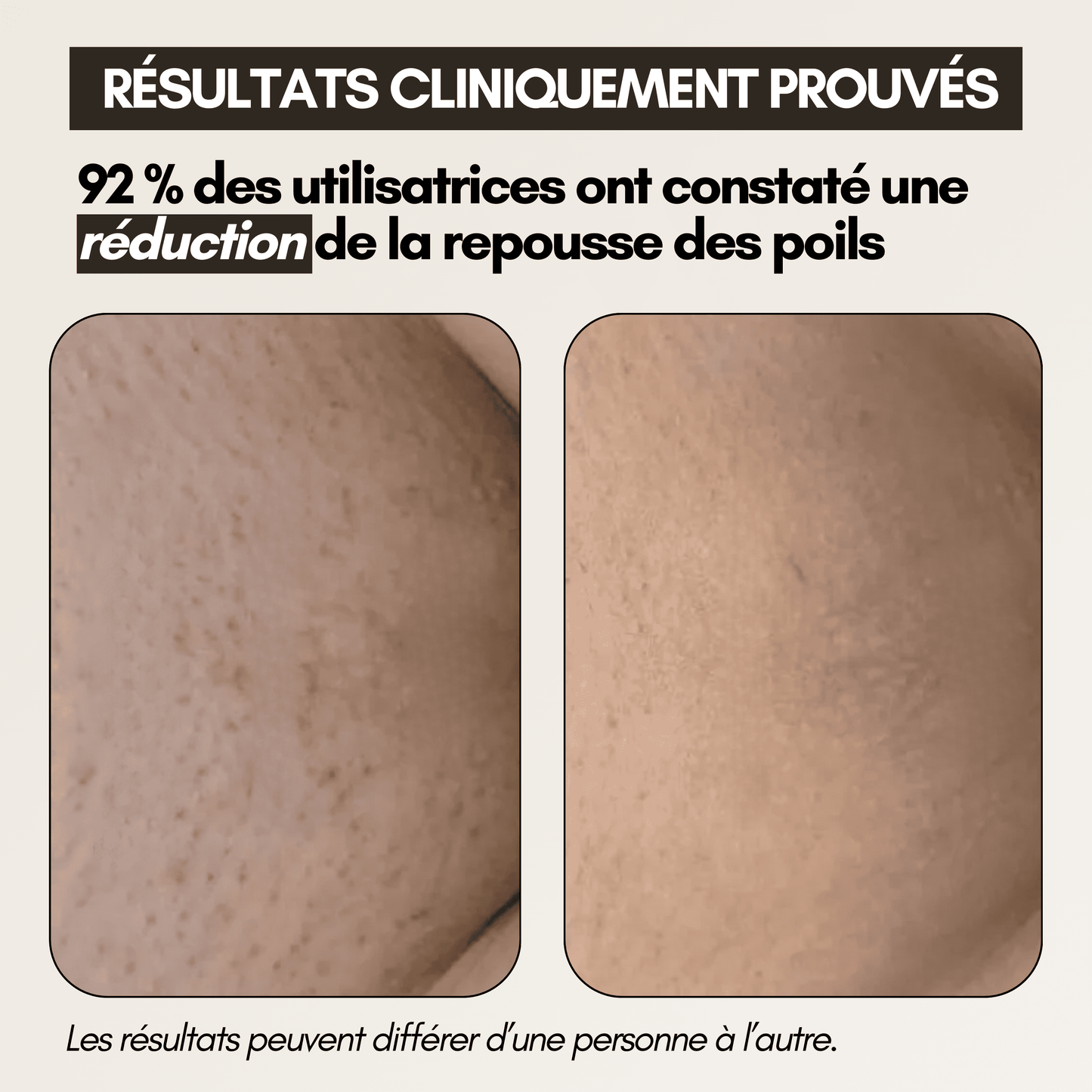 Cypure™ – Sérum Anti-Repousse Naturel