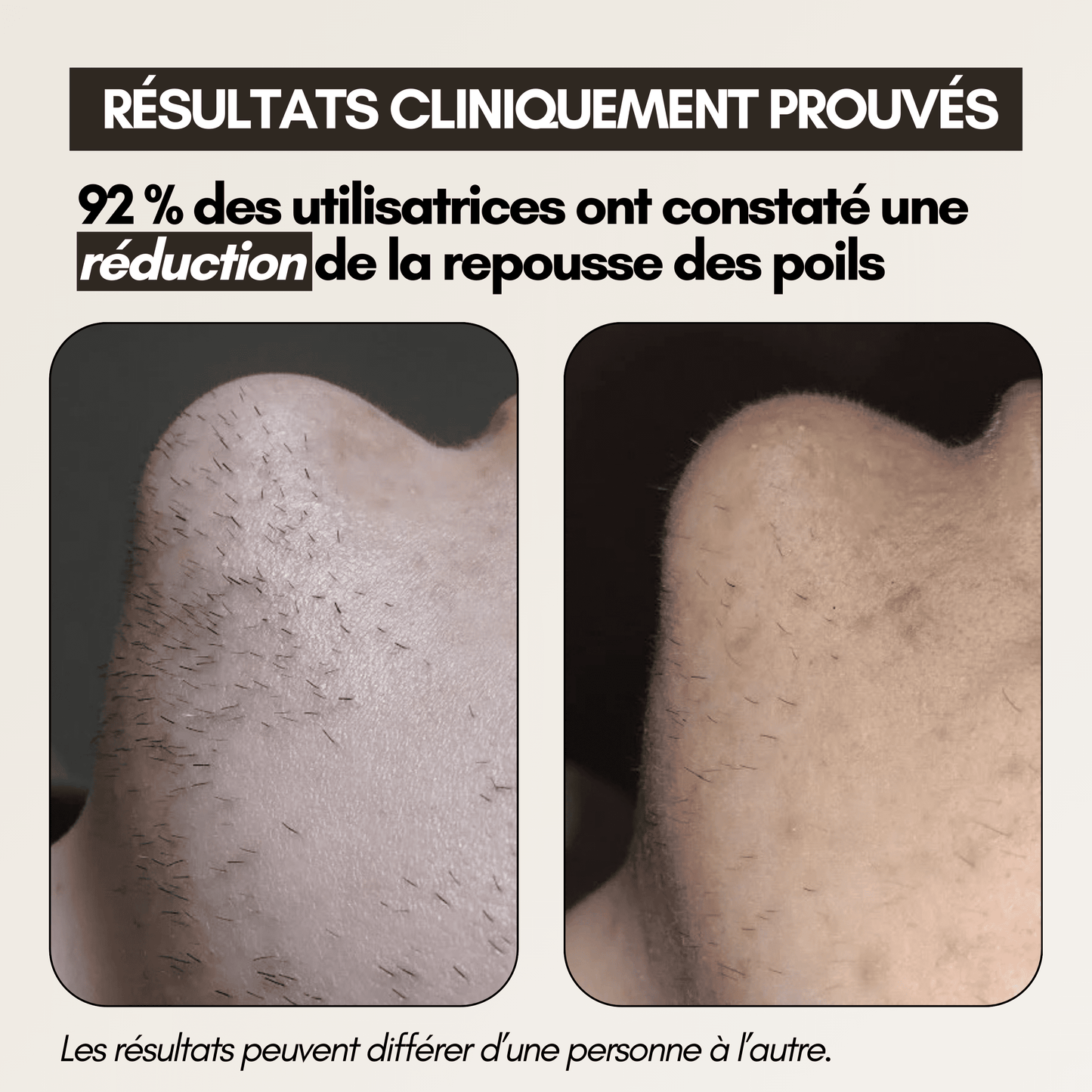 Cypure™ – Sérum Anti-Repousse Naturel