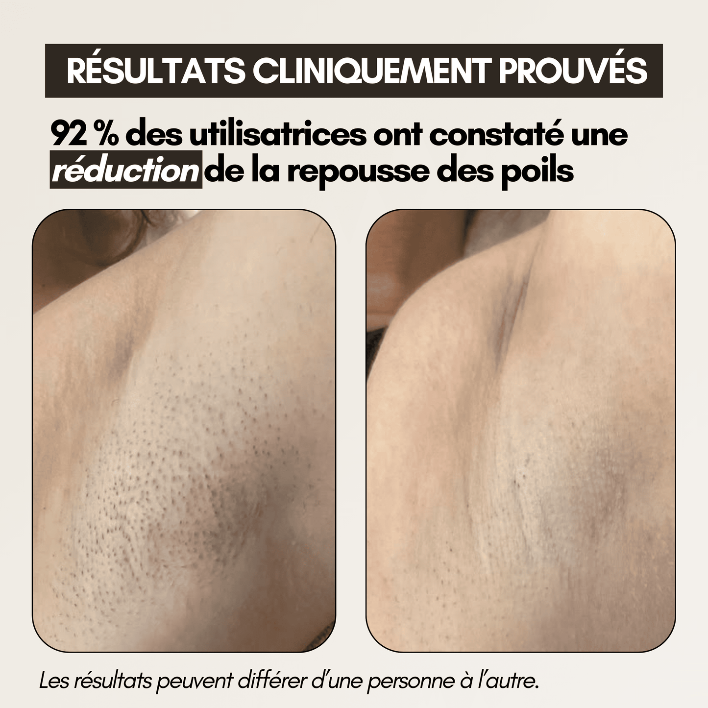 Cypure™ – Sérum Anti-Repousse Naturel