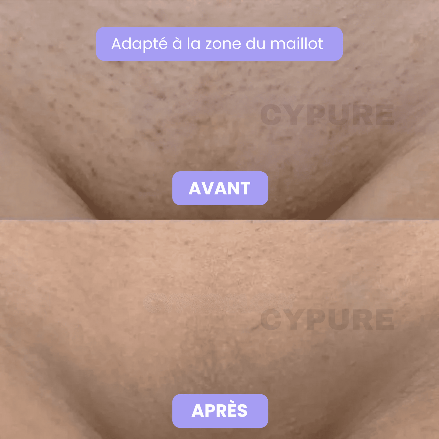 Cypure™ – Sérum Anti-Repousse Naturel