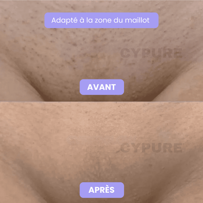 Cypure™ – Sérum Anti-Repousse Naturel