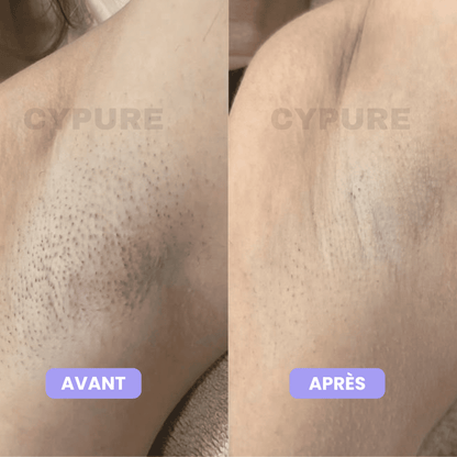 Cypure™ – Sérum Anti-Repousse Naturel