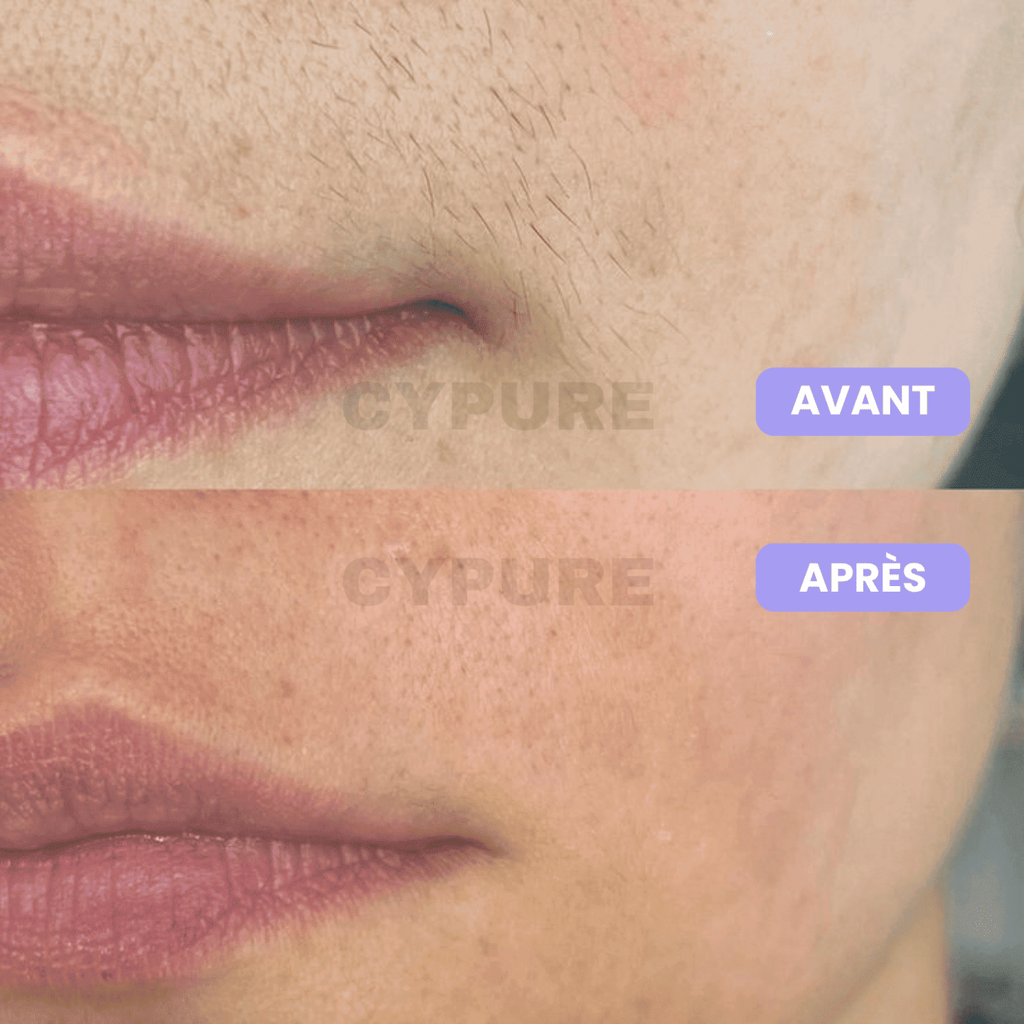 Cypure™ – Sérum Anti-Repousse Naturel