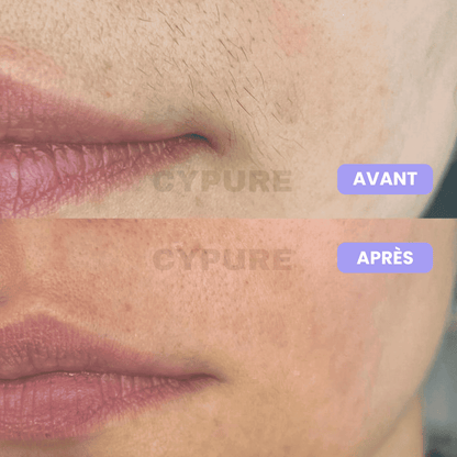 Cypure™ – Sérum Anti-Repousse Naturel